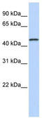 MAGE Family Member A10 antibody, TA346250, Origene, Western Blot image 