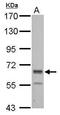 Fibronectin Leucine Rich Transmembrane Protein 2 antibody, PA5-32122, Invitrogen Antibodies, Western Blot image 