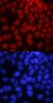 Pygopus Family PHD Finger 2 antibody, MAB3616, R&D Systems, Immunocytochemistry image 