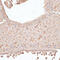 Protein CIP2A antibody, 14-340, ProSci, Immunohistochemistry paraffin image 
