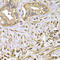 Fascin Actin-Bundling Protein 1 antibody, A02147, Boster Biological Technology, Immunohistochemistry paraffin image 