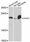 RAB25, Member RAS Oncogene Family antibody, LS-C747416, Lifespan Biosciences, Western Blot image 