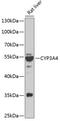 Cytochrome P450 Family 3 Subfamily A Member 4 antibody, 15-013, ProSci, Western Blot image 