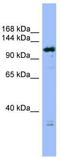 HAUS augmin-like complex subunit 6 antibody, TA344982, Origene, Western Blot image 