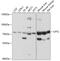 Carnitine O-palmitoyltransferase 2, mitochondrial antibody, 14-415, ProSci, Western Blot image 