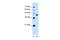 Solute Carrier Family 14 Member 1 (Kidd Blood Group) antibody, PA5-43133, Invitrogen Antibodies, Western Blot image 