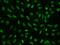 hMSH6 antibody, 202713-T02, Sino Biological, Immunohistochemistry frozen image 
