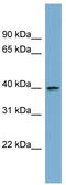 Aspartate Beta-Hydroxylase Domain Containing 2 antibody, TA344780, Origene, Western Blot image 