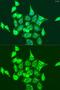 RAS Guanyl Releasing Protein 3 antibody, GTX33459, GeneTex, Immunocytochemistry image 