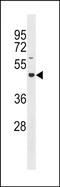 Glucoside Xylosyltransferase 2 antibody, PA5-49223, Invitrogen Antibodies, Western Blot image 