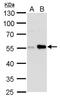Carbonic Anhydrase 9 antibody, PA5-77885, Invitrogen Antibodies, Western Blot image 