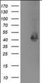 Microtubule-associated protein RP/EB family member 2 antibody, orb179003, Biorbyt, Western Blot image 