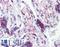 Serine/threonine-protein kinase ATR antibody, LS-B4288, Lifespan Biosciences, Immunohistochemistry paraffin image 