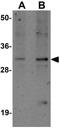 SLAM family member 9 antibody, GTX31427, GeneTex, Western Blot image 