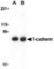 Cadherin 13 antibody, AHP1018, Bio-Rad (formerly AbD Serotec) , Western Blot image 