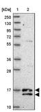 Chromosome 19 Open Reading Frame 25 antibody, NBP2-14391, Novus Biologicals, Western Blot image 