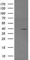 Mitogen-Activated Protein Kinase Kinase 3 antibody, TA505844S, Origene, Western Blot image 
