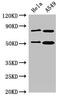 Sorting Nexin 27 antibody, CSB-PA842704LA01HU, Cusabio, Western Blot image 