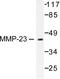 Matrix Metallopeptidase 23B antibody, LS-C176128, Lifespan Biosciences, Western Blot image 