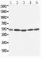 Kim1 antibody, PA1624, Boster Biological Technology, Western Blot image 