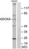 Uncharacterized aarF domain-containing protein kinase 4 antibody, TA315815, Origene, Western Blot image 