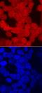 Cone-Rod Homeobox antibody, AF7085, R&D Systems, Immunocytochemistry image 