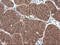 Cancer/Testis Antigen 1B antibody, LS-C174588, Lifespan Biosciences, Immunohistochemistry paraffin image 