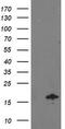 NADH:Ubiquinone Oxidoreductase Subunit A7 antibody, M10817-2, Boster Biological Technology, Western Blot image 