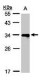 MHC II HLA-DR beta antibody, orb74136, Biorbyt, Western Blot image 