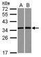 Ribosomal Protein S3A antibody, PA5-29398, Invitrogen Antibodies, Western Blot image 