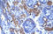 Checkpoint Kinase 1 antibody, ARP32589_P050, Aviva Systems Biology, Immunohistochemistry frozen image 