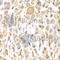 CD151 Molecule (Raph Blood Group) antibody, A1930, ABclonal Technology, Immunohistochemistry paraffin image 