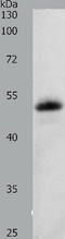 Serpin Family F Member 1 antibody, TA321509, Origene, Western Blot image 