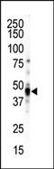 Calcium/Calmodulin Dependent Protein Kinase ID antibody, AP13881PU-N, Origene, Western Blot image 