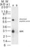 Ankyrin-like protein antibody, PA1-41505, Invitrogen Antibodies, Western Blot image 