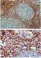 GX antibody, NBP2-31086, Novus Biologicals, Immunohistochemistry paraffin image 