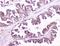 Cartilage Oligomeric Matrix Protein antibody, A02443-1, Boster Biological Technology, Immunohistochemistry paraffin image 