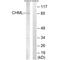 CHM Like Rab Escort Protein antibody, A08815, Boster Biological Technology, Western Blot image 