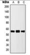 Cytochrome P450 Family 2 Subfamily D Member 6 antibody, orb360700, Biorbyt, Western Blot image 