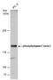 Phospholipase C Beta 3 antibody, GTX111100, GeneTex, Western Blot image 