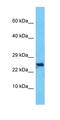 Uncharacterized protein C10orf131 antibody, orb327156, Biorbyt, Western Blot image 