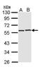 Cyclase Associated Actin Cytoskeleton Regulatory Protein 1 antibody, PA5-22241, Invitrogen Antibodies, Western Blot image 