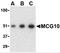 Poly(RC) Binding Protein 4 antibody, 2479, ProSci Inc, Western Blot image 