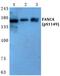 FA Complementation Group A antibody, A03662S1149, Boster Biological Technology, Western Blot image 