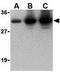 C1q And TNF Related 2 antibody, GTX85071, GeneTex, Western Blot image 