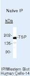 Thrombospondin 1 antibody, MA5-13398, Invitrogen Antibodies, Immunoprecipitation image 