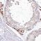Myotubularin-related protein 3 antibody, PA5-56961, Invitrogen Antibodies, Immunohistochemistry frozen image 