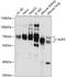 Alkylglycerone Phosphate Synthase antibody, A03481, Boster Biological Technology, Western Blot image 