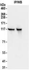 Kinesin Family Member 5B antibody, NBP2-32278, Novus Biologicals, Immunoprecipitation image 