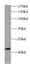 Isovaleryl-CoA dehydrogenase, mitochondrial antibody, FNab04427, FineTest, Western Blot image 